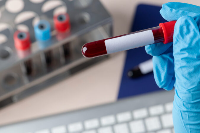 Unifesp lidera debate nacional sobre novas formas de uso seguro e racional do sangue em hospitais