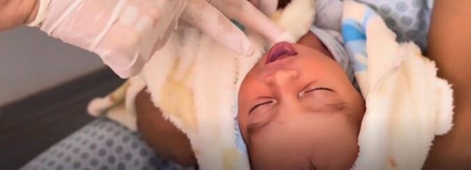Policlínica de Formosa reforça a importância do acompanhamento especializado para a saúde orofacial